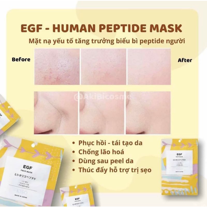 Mặt Nạ Tế Bào Gốc Cao Cấp Kiso Nhật Bản