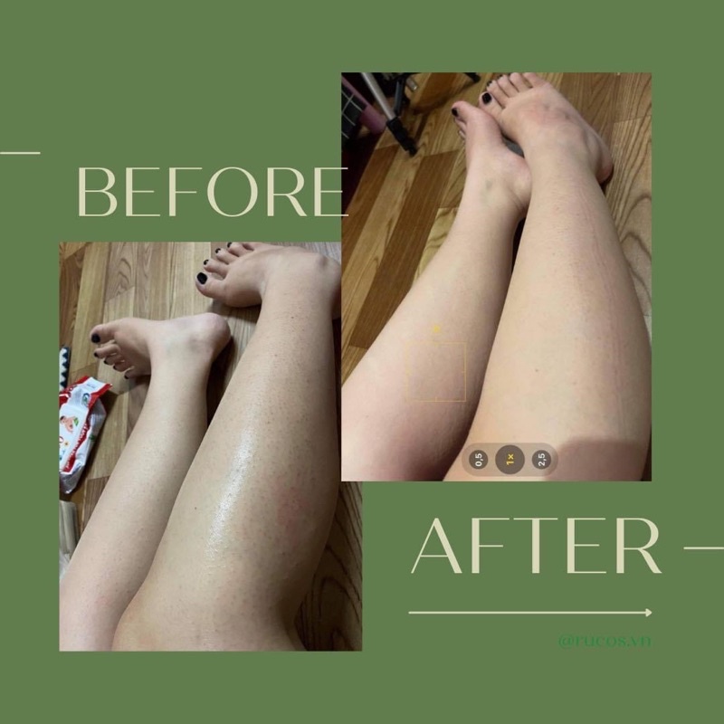 Dầu Dưỡng Da Body Oil 4% BHA Rucos