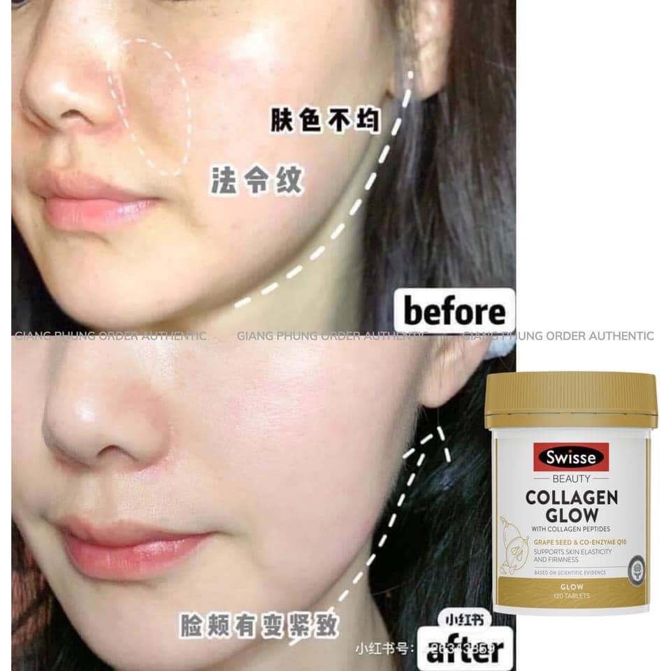 [Hàng Chuẩn ÚC] Swisse Beauty Collagen Glow - Viên uống đẹp da trẻ hóa collagen thủy phân 60/120 viên