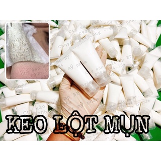 keo lột mụn handmade
