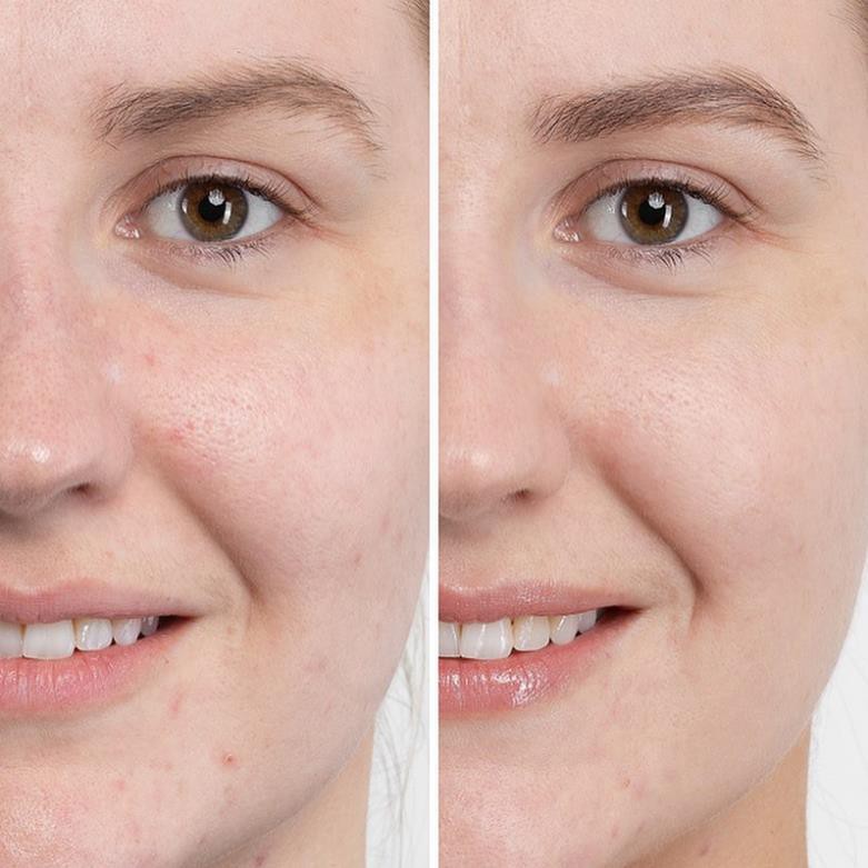 Serum Caudalie Vinopure Skin Perfecting Serum giảm dầu, thu nhỏ lỗ chân lông 10ml Mini