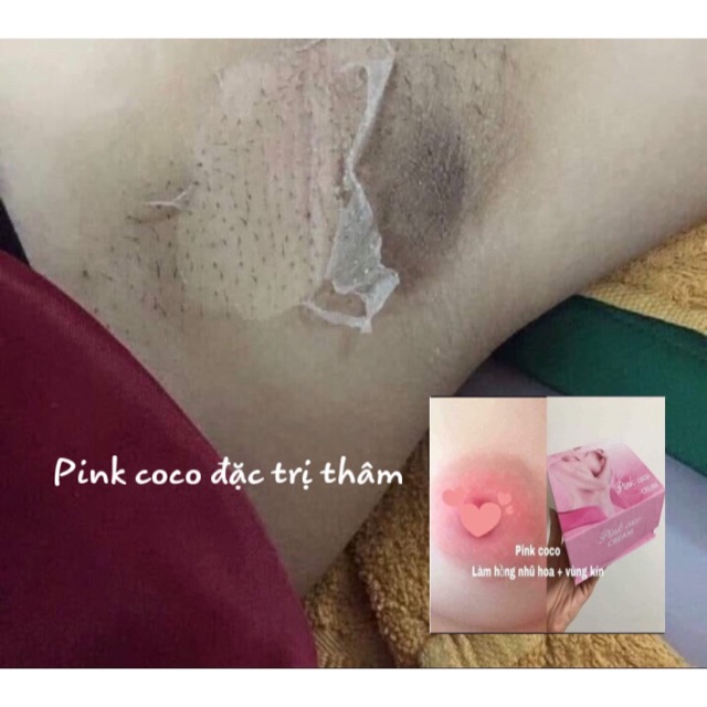 Kem ngừa thâm nách Pink Coco