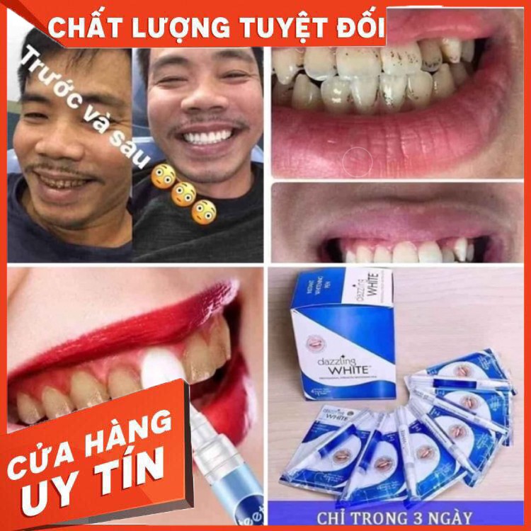 Bút trắng răng Dazzling White. Lấy sỉ ib
