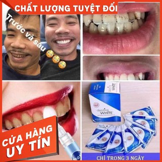 Bút trắng răng Dazzling White. Lấy sỉ ib