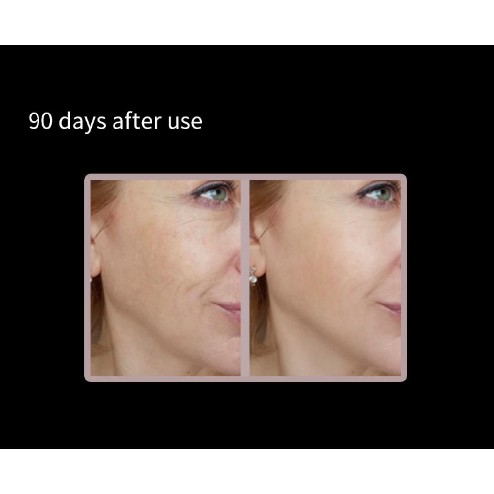 Máy mát xa da mặt thông minh điều khiển từ xa kết nối bluetooth | BigBuy360 - bigbuy360.vn