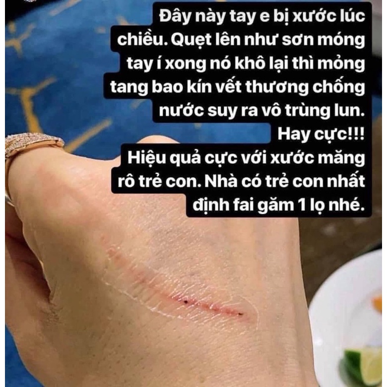 Gel đứt tay 10g Kobayashi Nhât | BigBuy360 - bigbuy360.vn