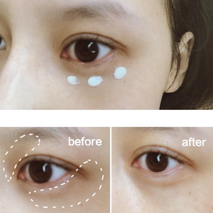L'OREAL L 'Oreal Kem Dưỡng Ẩm Chống Nếp Nhăn Cho Mắt 30ml