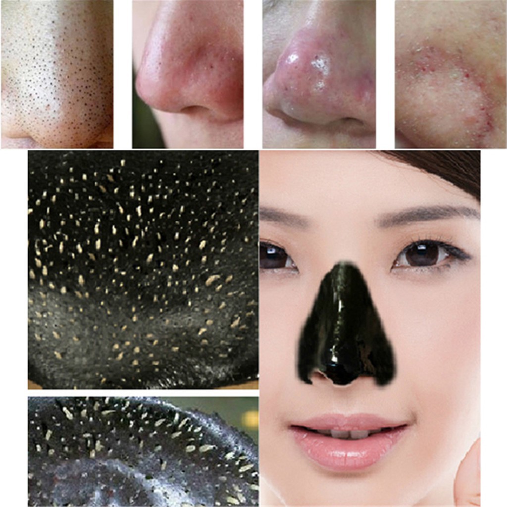 Mặt nạ lột mụn Black Mask giúp se khít lỗ chân lông, mịn da sau khi lột, điều này khác biệt so với lột mụn thông thường