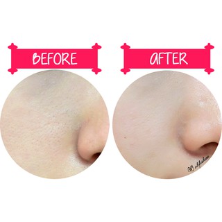 Serum VitaminC Melano CC Rohto