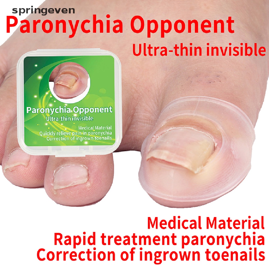 Dụng Cụ Silicone Hỗ Trợ Chỉnh Hình Móng Chân Mọc Ngược