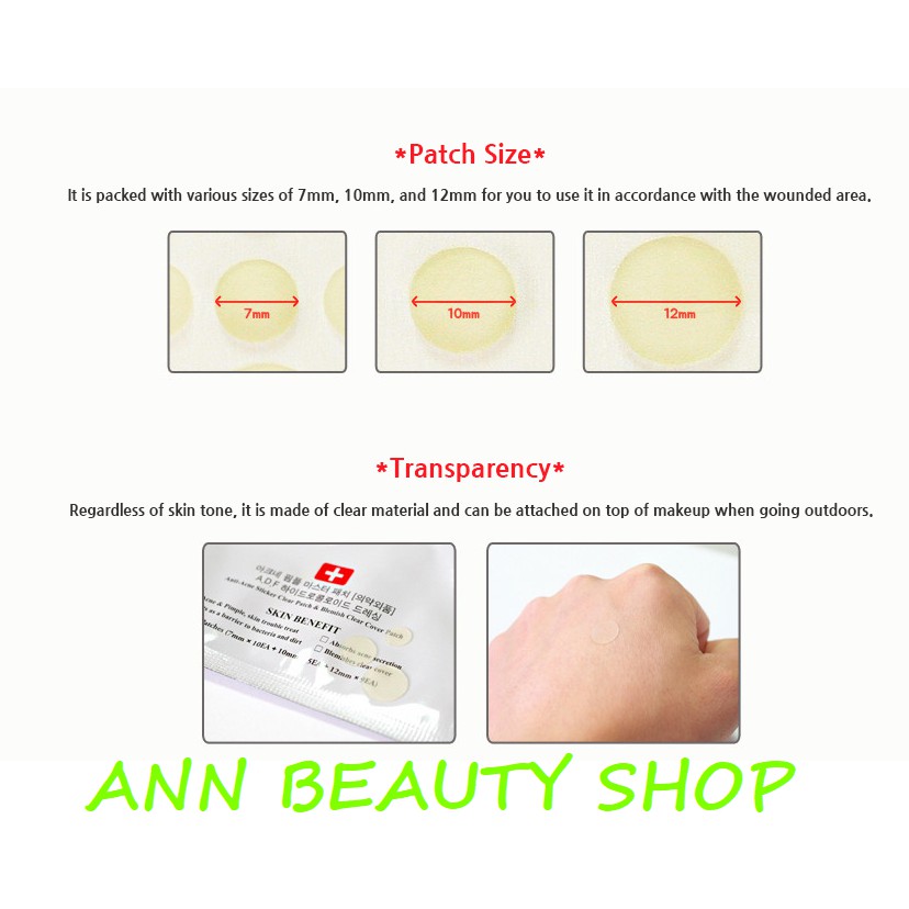 Miếng Dán Mụn Cosrx | BigBuy360 - bigbuy360.vn