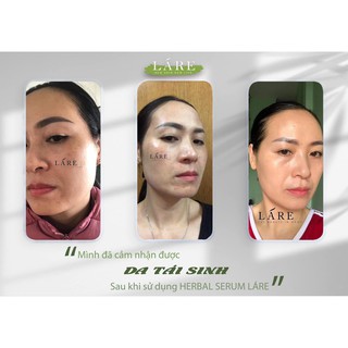 30ml serum Thanh Dược Lare