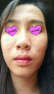 Thảo dược Đông y Sắc Mộc Lan