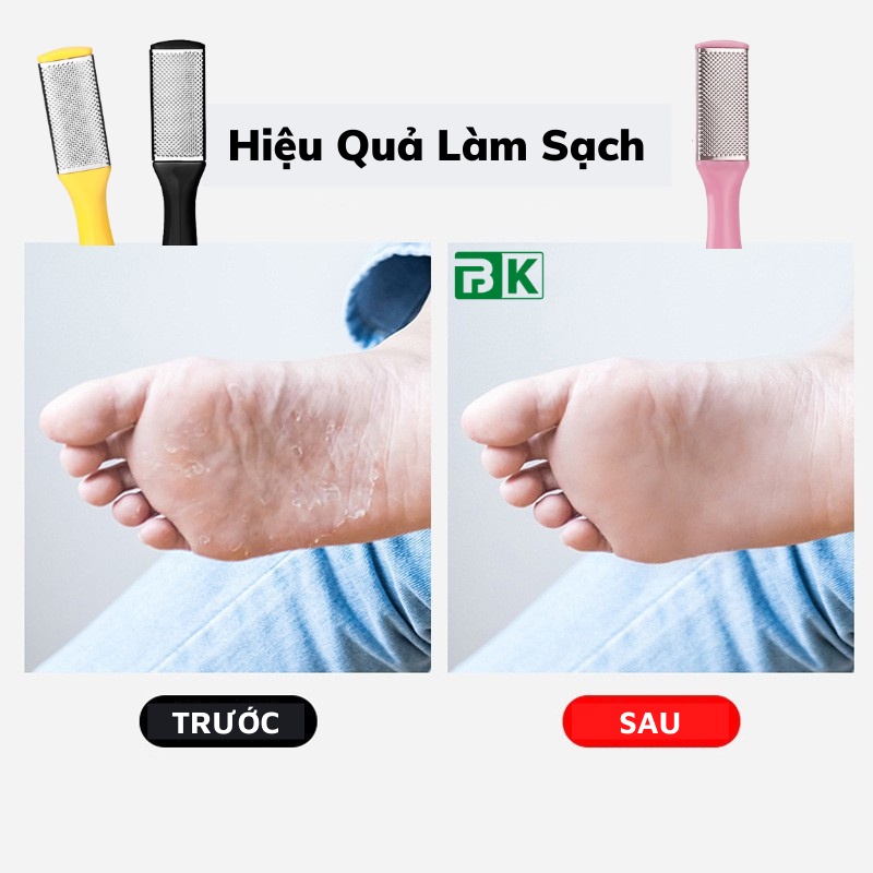 Dụng Cụ Chà Gót Chân, Cọ Gót Chân - Tẩy Da Chết, Làm Mềm Mịn Gót Chân - Cấu Tạo Từ Nhựa Cứng & Inox