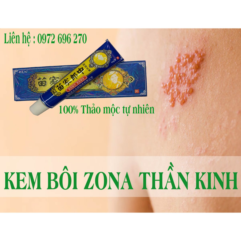 KEM BÔI ZONA THẦN KINH - HẾT NGỨA SAU 30 PHÚT [ CỰC HIỆU QUẢ]