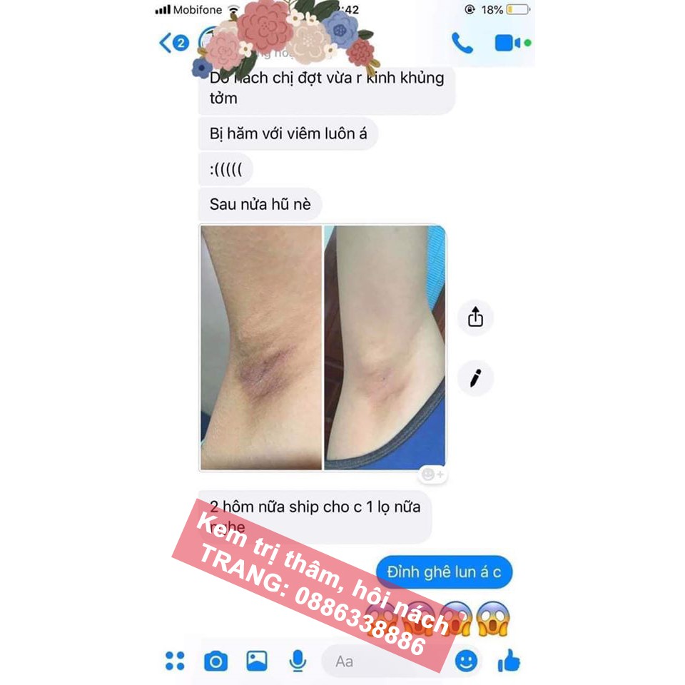 Kem khử thâm nách hôi nách handmade | BigBuy360 - bigbuy360.vn