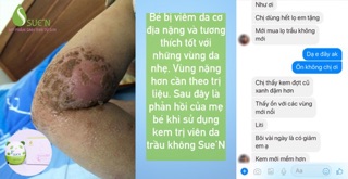 KEM TRỊ VIÊM DA TRẦU KHÔNG SUE’N