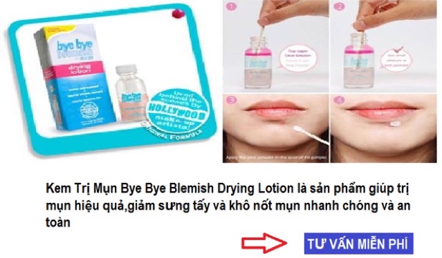 ☀️☀️ Kem Chấm Mụn - Bye Bye Blemish For Acne Drying Lotion