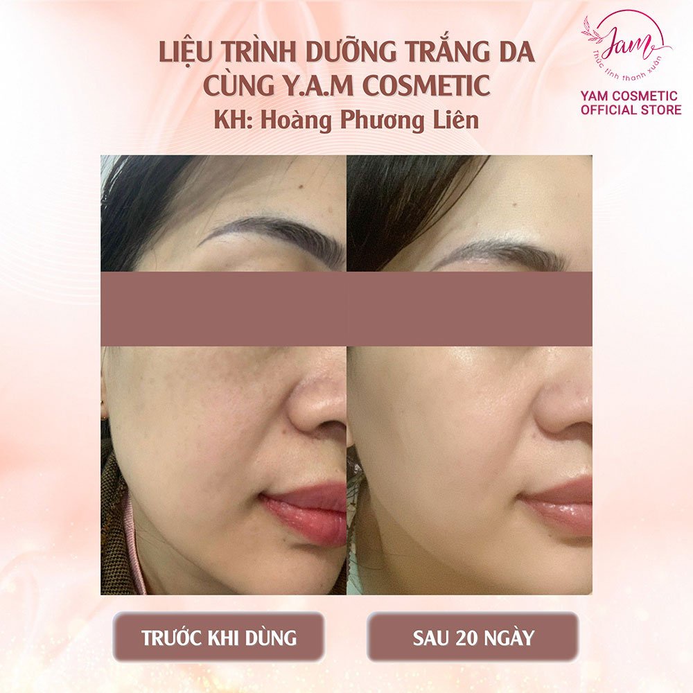 Bộ Dưỡng Trắng Sáng Da YAM Cosmetic Giúp Da Trắng Mờ Thâm Nám Hiệu Quả Serum 30ml Cream 30g