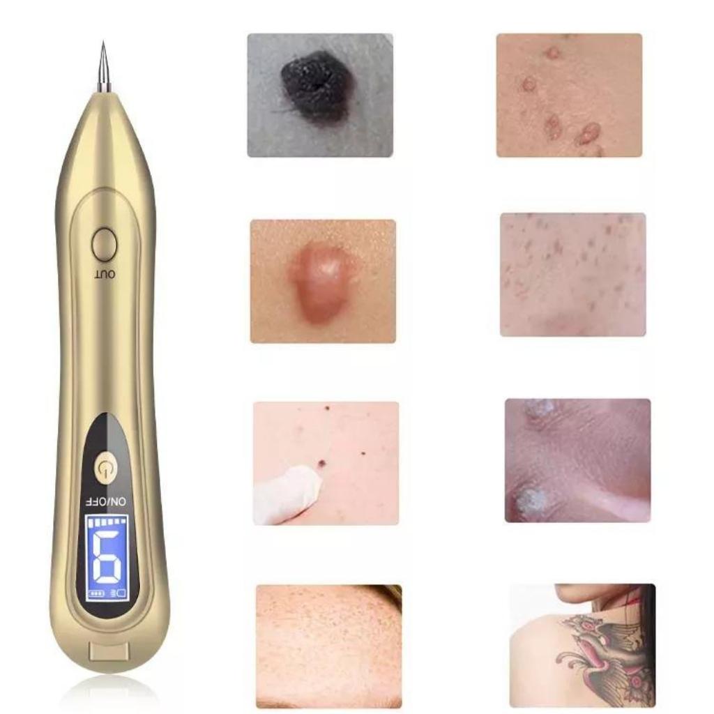 Máy đốt nốt ruồi, đốt mụn thịt, tàn nhang cầm tay mini BẢN MỚI NHẤT tẩy nốt ruồi mạnh - Dinh Dinh máy làm đẹp