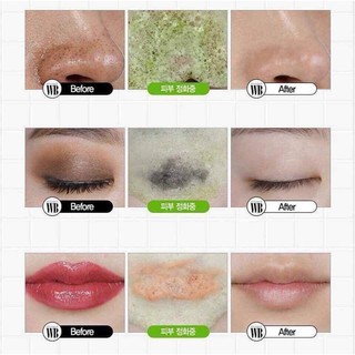 SỬA RỬA MẶT THẢI ĐỘC DA RAU CỦ QUẢ