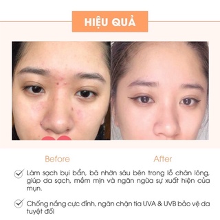 Combo Kem Face Pháp và Serum Spot A Cosmectics