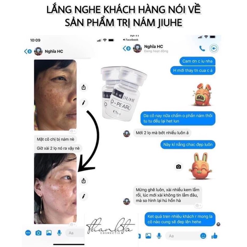 SERUM JIUHE THANH TÔ CHÍNH HÃNG 100% - JIUHE VUA GIẢM THÂM MẪU MỚI