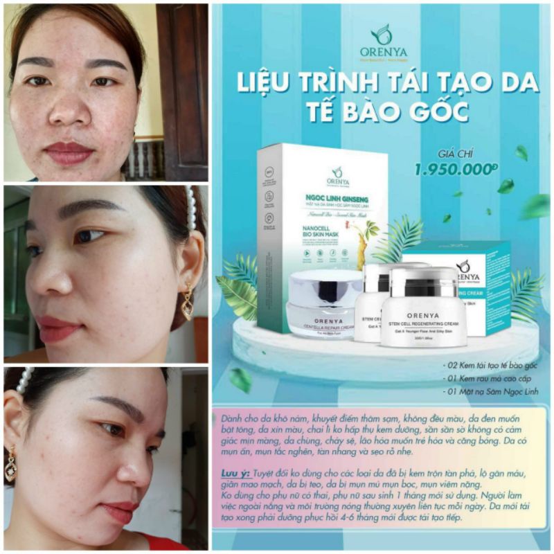 Kem Tái Tạo Tế Bào Gốc – Stem Cell Regenerating - ORENYA