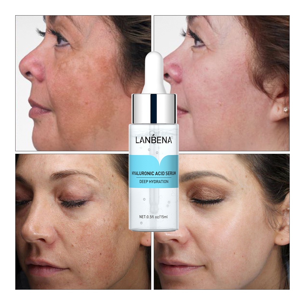 Kem/ serum LANBENA axit hyaluronic dưỡng ẩm làm dịu da chống nhăn 15ml