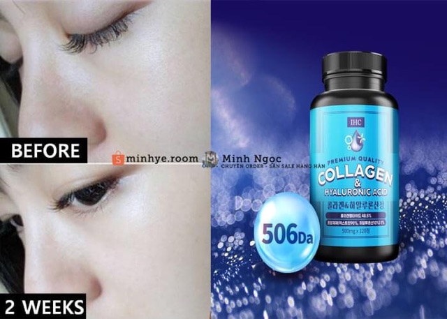 Viên Uống Collagen, Viên Uống Cấp Nước IHC 2In1 Sự Kết Hợp Tuyệt Vời Cho Da Cực Kì Hiệu Quả Vừa Chống Già Vừa Căng Da | BigBuy360 - bigbuy360.vn