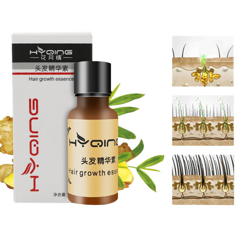 Tinh chất gừng giúp tăng trưởng tóc chất lượng cao