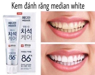 Kem đánh răng siêu trắng răng