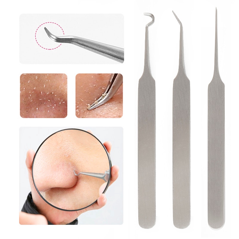 Set 3 Dụng Cụ Nặn Mụn Đầu Đen Bằng Thép Không Gỉ Tiện Dụng