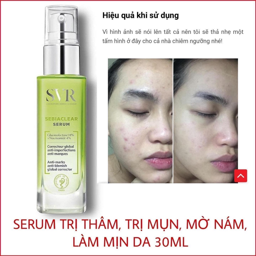 Serum SVR Giảm Mụn, Mờ Nám, Chống Nhăn, Thông Thoáng Lỗ Chân Lông, Mềm Mịn Da 30ml