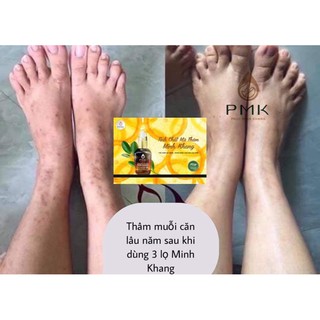 Tinh Chất Mờ Thâm Minh khang( tặng ngay 1 thâm gia truyền 120k)