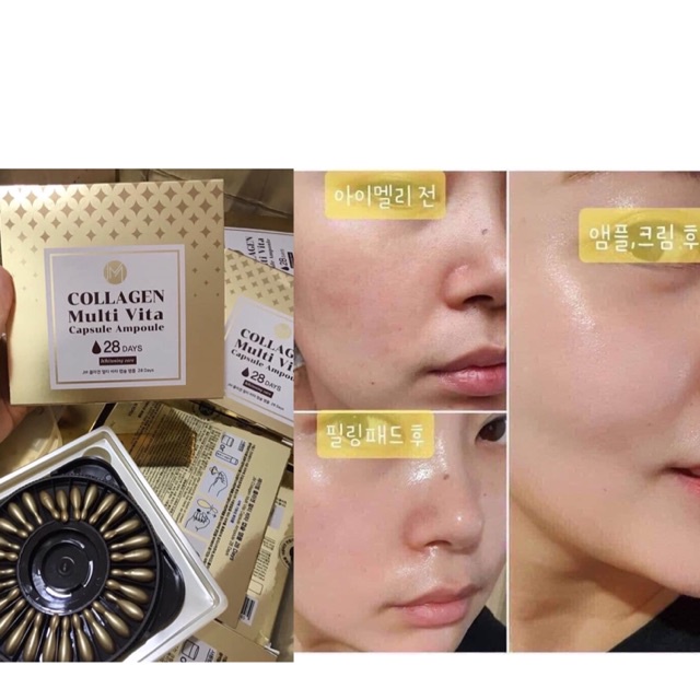 Viên Collagen Multi Vita Dưỡng Ẩm Chống Lão Hóa JMsolution