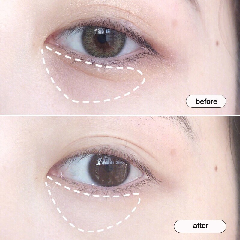 (Hàng Mới Về) MATLEE Kem Dưỡng Da Vùng Mắt Chống Nếp Nhăn Và Quầng Thâm 15g | BigBuy360 - bigbuy360.vn