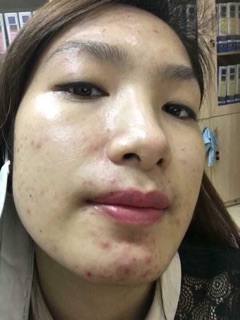 Combo 6 gói Cám Gạo Cà Phê HANDMADE
