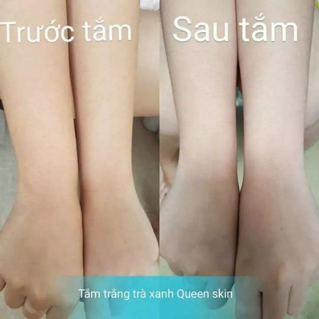 TẮM TRẮNG TRÀ XANH QUEENIE SKIN