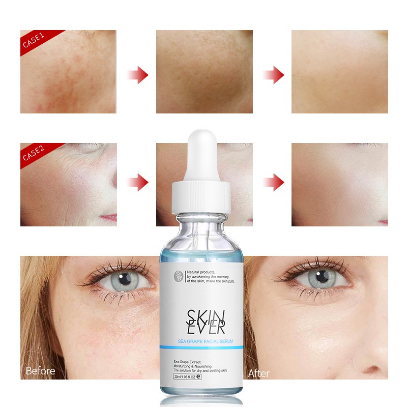 Serum SKIN EVER Dung Tích 30ml Dưỡng Ẩm Chăm Sóc Da Mặt Từ Nho Biển 30ml