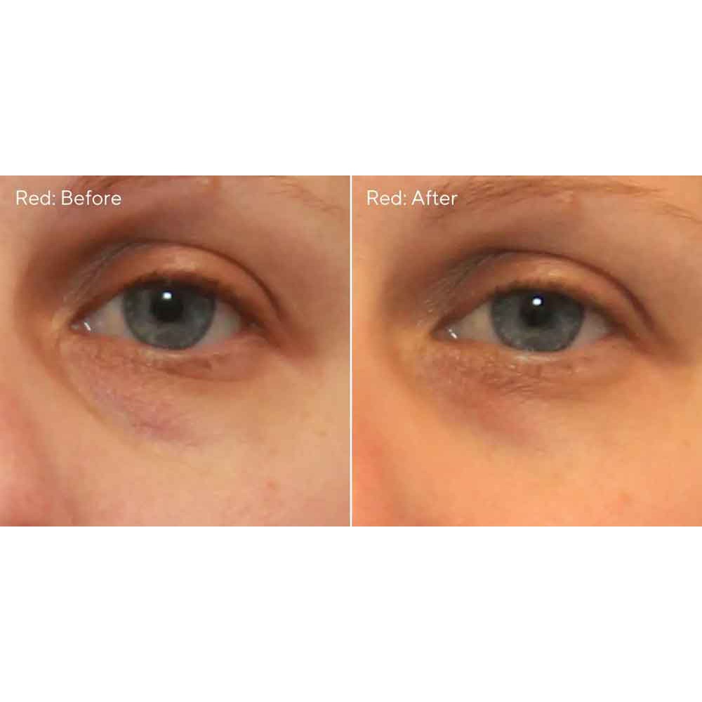 Kem giúp giảm quầng thâm mắt thế hệ mới Muza Vita-C Eyes Dark Circle Corrector