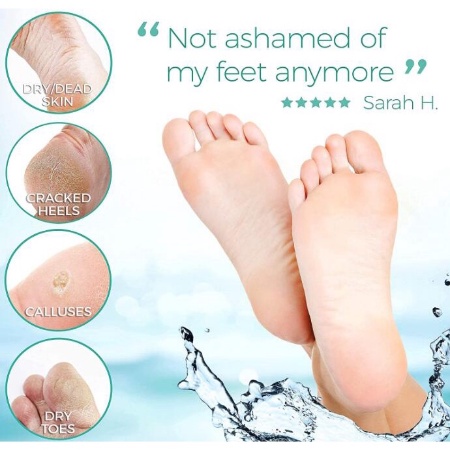 Mặt nạ bàn chân tẩy da chết với chiết xuất hoa oải hương dưỡng ẩm và làm trắng da