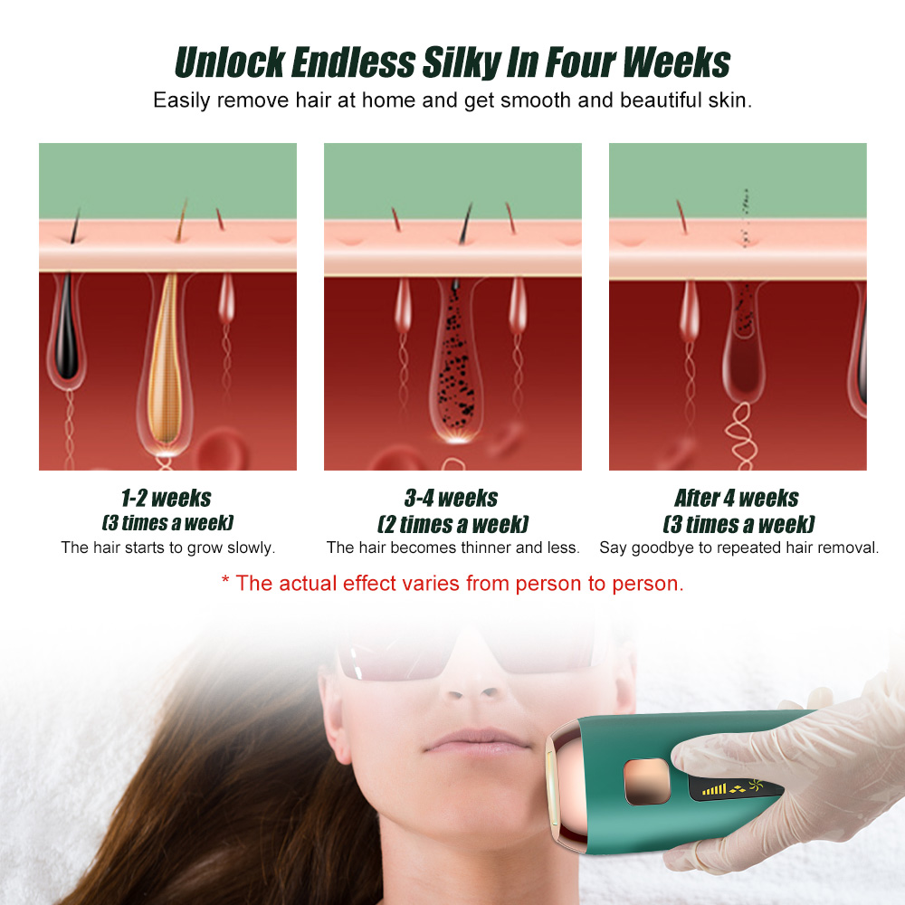 Máy tẩy lông laser IPL Suolaer sử dụng điện chuyên nghiệp phù hợp cho nữ