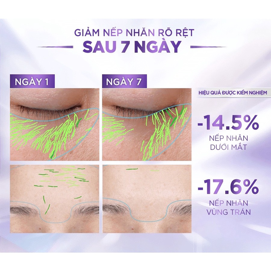 [Mini 7.5ml] Tinh Chất Cấp Ẩm, Cải Thiện Nếp Nhăn L'Oreal Revitalift 1.5% Hyaluronic Acid Serum