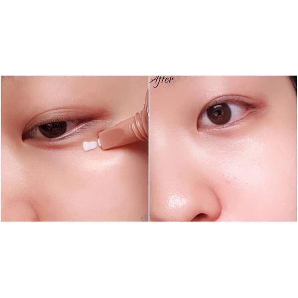 Kem Dưỡng Mắt Làm Trắng Và Cải Thiện Nếp Nhăn Mắt AHC Ageless Real Eye Cream For Face