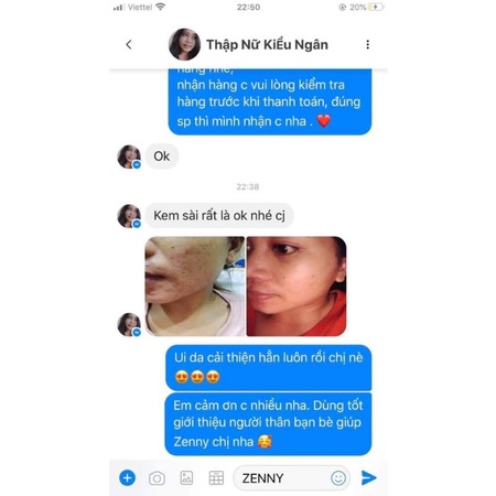 Kem Đêm Zenny Platinum Mua 1 Tặng 1