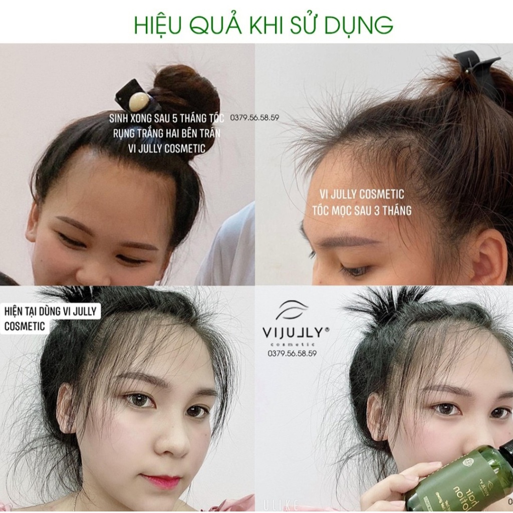 COMBO DẦU GỘI+ DẦU XẢ+ XỊT BƯỞI VIJULY (hàng công ty 100%)