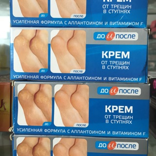 Kem trị nứt chân Nga Kpem 50ml