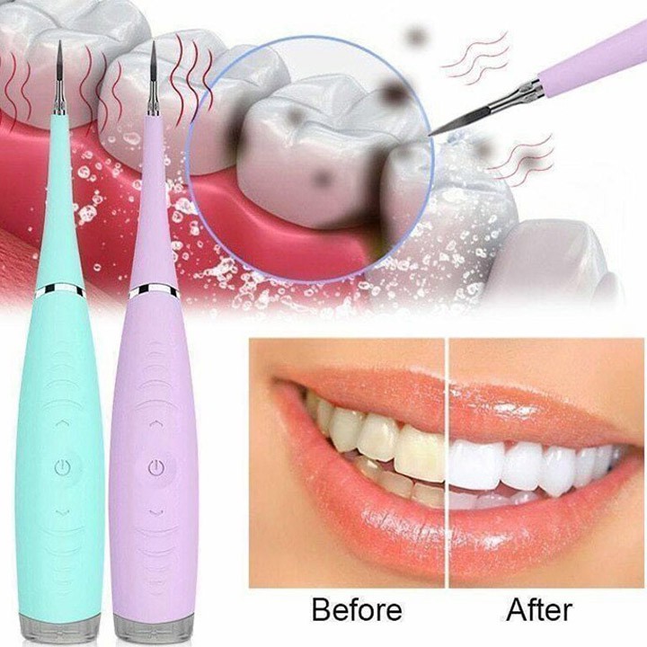 Dụng cụ lấy cao răng Mới