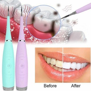 Dụng cụ lấy cao răng Mới